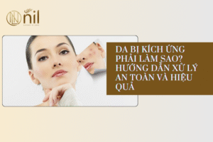 Da bị kích ứng phải làm sao