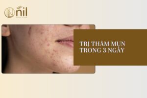 Trị thâm mụn trong 3 ngày