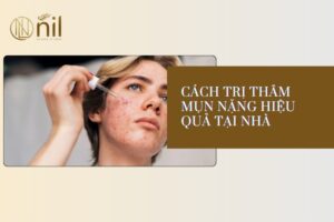 Cách trị thâm mụn nặng