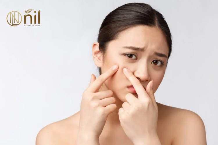 Tại Sao Da Bị Mụn?