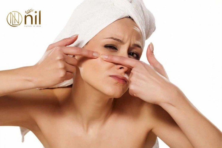 Cách trị thâm mụn nặng bằng nguyên liệu tự nhiên
