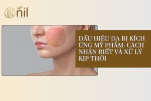 Dấu hiệu da bị kích ứng mỹ phẩm
