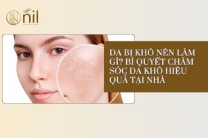 Da bị khô nên làm gì ?