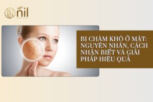 Bị chàm khô ở mặt