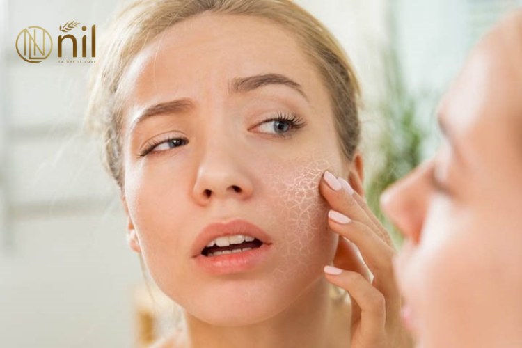 Dấu hiệu nhận biết da khô