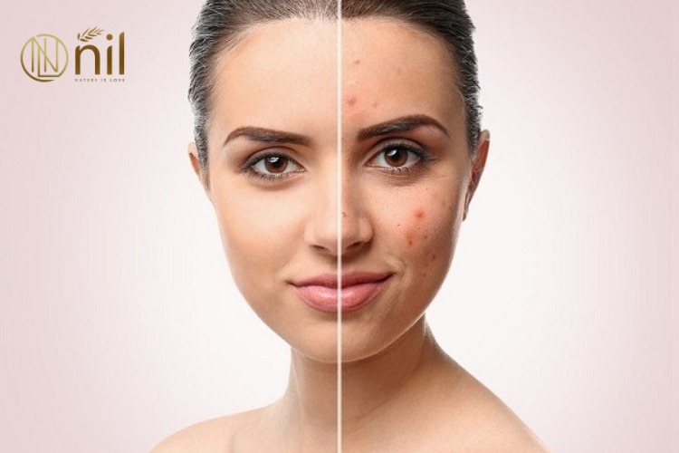 Kết hợp chăm sóc da đúng cách để tăng hiệu quả