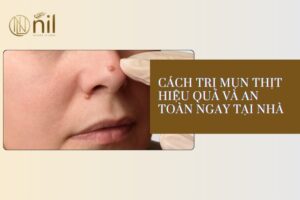 cach tri mun thit