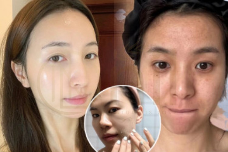 Tế bào chết là gì và vì sao phải loại bỏ?