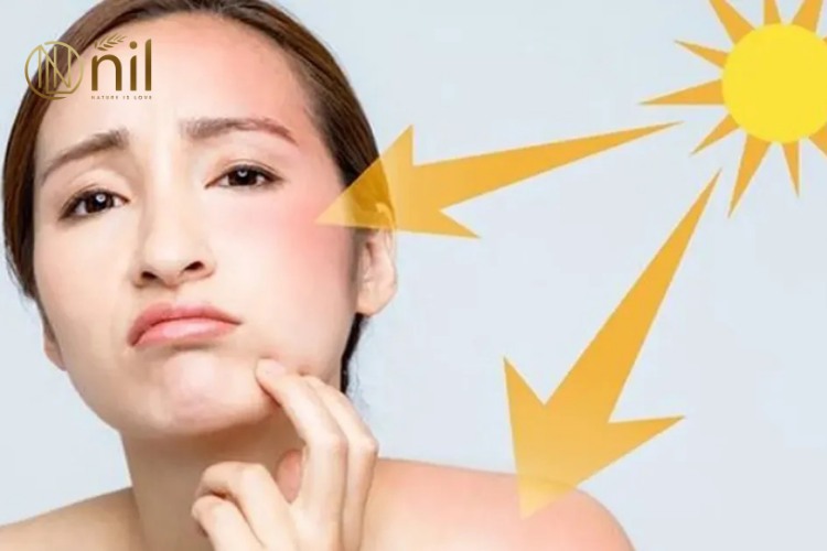 Gợi ý top kem chống nắng tốt nhất hiện nay