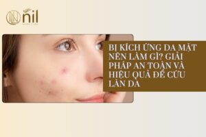 bi kich ung da mat nen lam gi