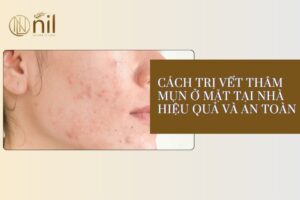 cach tri vet tham mun o mat tai nha
