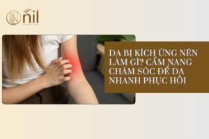 da bi kich ung nen lam gi