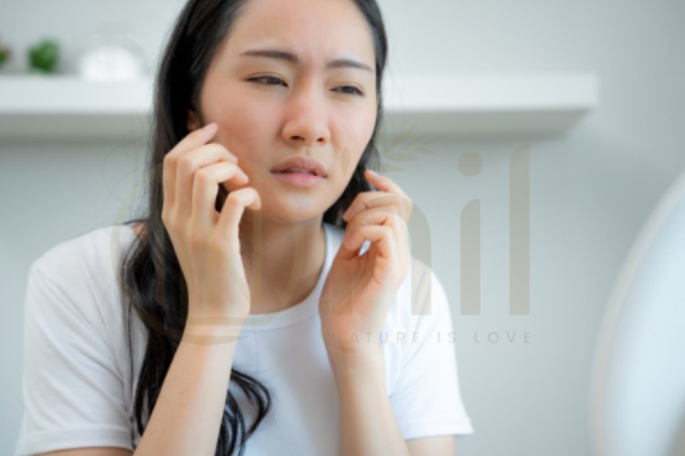 Nhận biết da mặt bị kích ứng