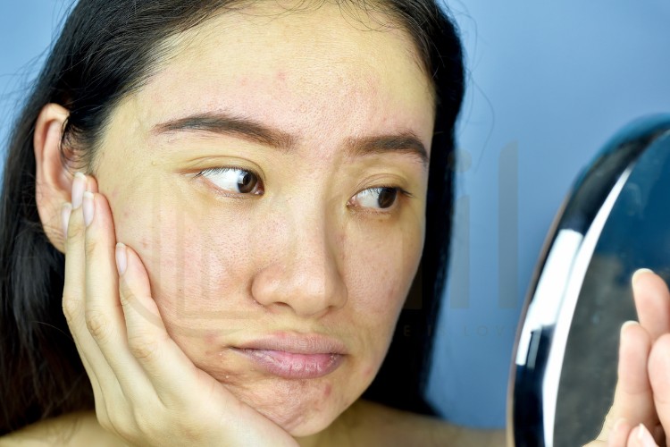 Nhận diện dấu hiệu kích ứng da