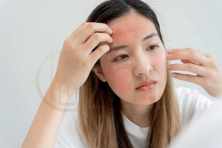 Cách phòng tránh tình trạng da bị kích ứng