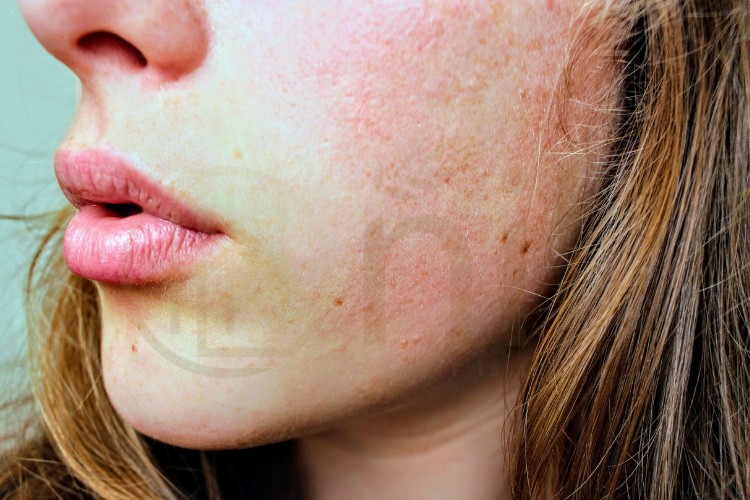 Làm dịu da bằng các sản phẩm cấp ẩm dịu nhẹ