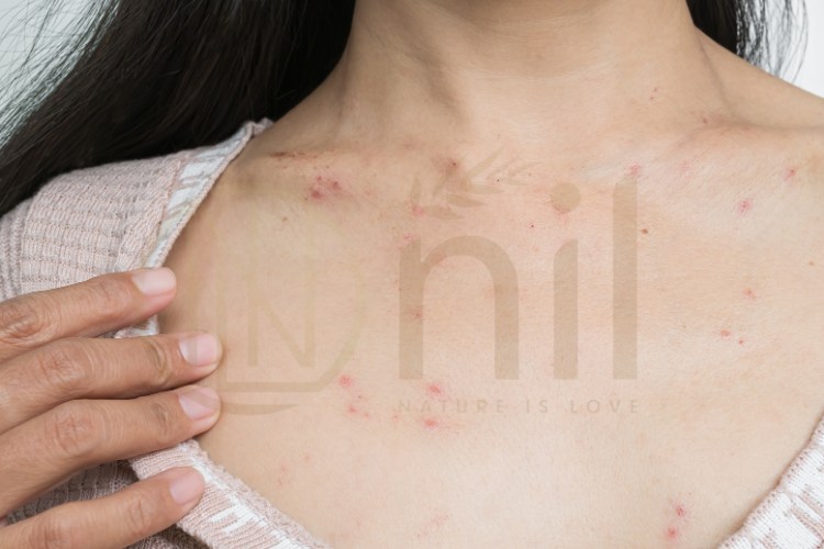 Xác định nguyên nhân gây kích ứng