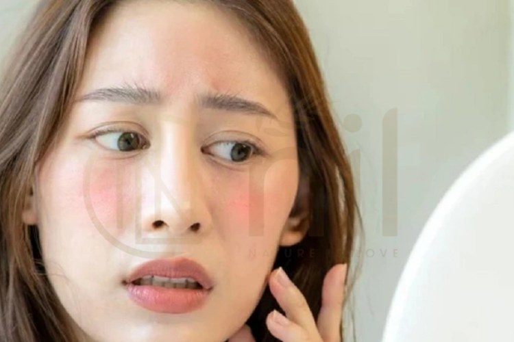 Bị kích ứng da mặt nên làm gì ngay lập tức?