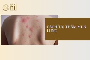 cach tri tham mun lung