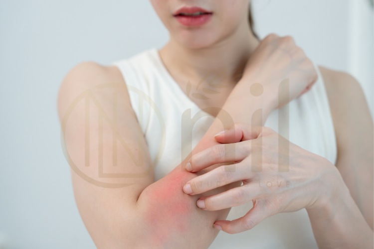 Dấu hiệu nhận biết da bị kích ứng