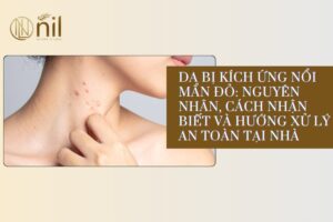 da bi kich ung noi man do