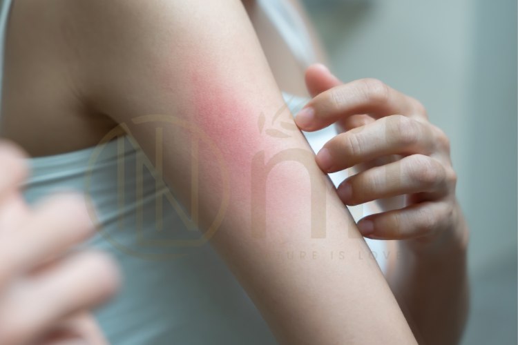 Khi nào cần đi khám bác sĩ da liễu?