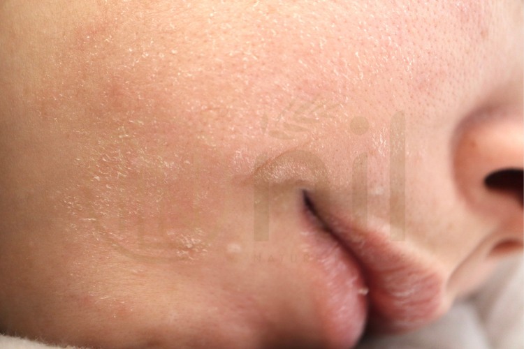 Nhóm da khô nhưng thích da mịn, sáng